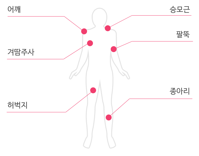 보톡스 장소